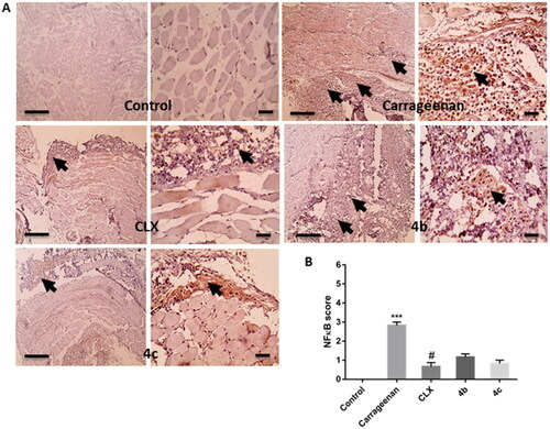 Figure 8. (A) Representative images of immunostained paw sections showing NF-κB positive expression (arrows). (B) Semi-quantitative scoring of NF-κB positive expression. *** p < 0.001 in comparison to the control group; # p < 0.05 compared to the carrageenan group.