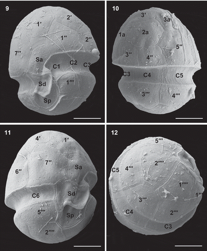 Figs 9–12. Scanning electron micrographs of vegetative cells of Caladoa arcachonensis strain TIO278 from France. Fig. 9. Ventral view showing the first apical plate (1′), anterior sulcal plate (Sa), right sulcal plate (Sd), posterior sulcal plate (Sp) and the first three cingular plates (C1–C3). Fig. 10. Dorsal view showing three anterior intercalary plates (1a–3a), three precingular plates (3′′–5′′), three cingular plates (C3–C5) and two postcingular plates (3′′′, 4′′′). Fig. 11. Ventral-lateral right view showing two precingular plates (6′′, 7′′), sixth cingular plate (C6) and fifth postcingular plate (5′′′). Fig. 12. Dorso-antapical view showing five postcingular plates (1′′′–5′′′) and two antapical plates (1′′′′, 2′′′′) of similar size. Scale bars = 5 μm.