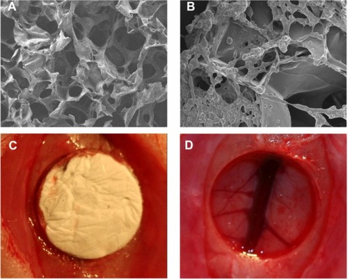 Figure 5 SEM image of gelatin sponge with or without PLGA@pBMP-2/PEI and representative photos of bone defect with or without treatment. (A) SEM image of gelatin sponge without PLGA@pBMP-2/PEI; (B) SEM image of gelatin sponge with PLGA@pBMP-2/PEI; (C) Cranial bone defect with gelatin sponge loaded PLGA@pBMP-2/PEI treatment; (D) Cranial bone defect without treatment (5 mm diameter).Abbreviations: SEM, Scanning Electron Microscopy; PLGA@pBMP-2/PEI, poly(lactic-co-glycolic acid)@plasmid of bone morphogenetic protein 2/polyethlenimine.