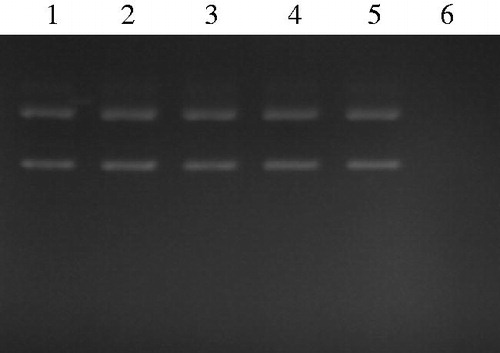 Figure 1. Gel electrophoresis pattern of the DNA plasmid incubated with Fenton’s reagent both in the presence and in the absence of flowers extracts from D. Simplex. Lane 1: untreated control: native DNA plasmid (0.5 μg); lanes 2 and 3: DNA with ethyl acetate extract at 500 and 250 μg/mL, respectively; lanes 4 and 5: DNA with ethanol extract at 500 and 250 μg/mL, respectively; lane 6: DNA sample incubated with Fenton’s reagent.