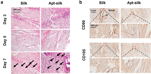 Figure 6. Histologic analysis of cell infiltration into the artificial ligaments. (A) Representative HE staining images of the rabbit joint samples with silk ligaments. Black arrow indicates infiltrated cells. (B) Immunohistochemistry of mesenchymal stem cell marker CD90/CD105 of the recruited cells at Day 7. The silk ligament-implanted interface with bone tunnel is outlined with a red rectangle and magnified in close-up views.