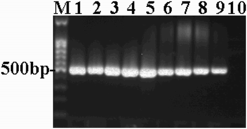 Figure 4. The PCR-amplified B fragments of the UL2 gene. M: 100-bp DNA ladder; 1–4: virulent strains (DPV Guangxi01strain, Guangxi02 strain, Yulin2016-60D strain and Yulin2016-30D strain); 5–9: attenuated vaccine strains (Harbin Pharmaceutical Group Bio-vaccine, Co., Ltd., Guangxi Liyuan Biological Co., Ltd., Shanghai Hile Bio-Technology, Co., Ltd. and Liaoning Yikang Biological, Co., Ltd.); 9: AV18 strain (attenuated strain); 10: Normal duck embryo allantoic fluid.