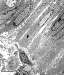 Figure 7 Electron microscopy of intestinal mucosa to assess epithelial damage. Typical electron micrograph of transverse section through intestinal villus (away from Peyer's patch) from rat that had been injected with 0.5 ml HBS-2% BSA, followed 2 minutes later by 50 mg DBBF-Hb. The experiment was terminated 30 minutes after the DBBF-Hb injection. The epithelial cells (E) are much closer together than after 8 minutes perfusion with DBBF-Hb, and the cytoplasmic protuberances are much less evident, indicating some repair of the epithelial lining. Villi near Peyer's patches were even more intact. Scale bar: 5 microns.