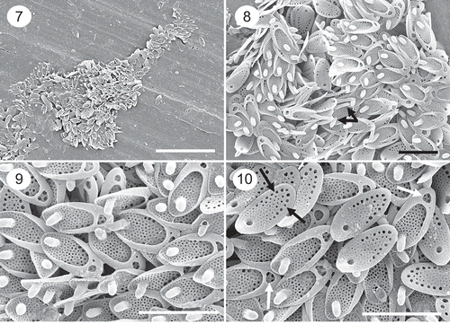 Figs 7–10. SEM images of a population of Synura synuroidea from Orchid Bog, Newfoundland, Canada, where cells of the two-celled colonies were club-shaped and attached by the tapered ends. Fig. 7. Remains of a whole cell showing the club-shape morphology. Figs 8–10. Groups of scales depicting the large posterior rim, base plate pores and forward projecting spine. Scales with longer spines representing the anterior-most portion of the cell are depicted in Fig. 8 (black arrows). The majority of scales on cells in this population have a single large hole in the posterior rim (Fig. 10, white arrows). The row of large base plate pores aligning the posterior marginal are illustrated in Fig. 10 (black arrows). Scale: 2 µm (Figs 8–10) and 10 µm (Fig. 7).