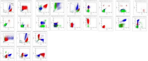 Figure 4 Immunophenotyping by flow cytometry of the blasts at acute B-lymphoid leukemia phase.