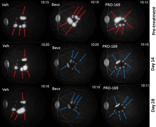 Figure 3 Bevacizumab and PRO-169 attenuate laser-induced CNV. Fluorescein fundus angiography (FFA) of vehicle (Veh), bevacizumab (Bevz) and PRO-169 (IVT delivery of 1.25 mg/eye, on post-operative day 21). Images provide representative examples of grade III and IV lesions identified by red arrows (pre-treatment phase), and the reduction of leakage area by blue arrows in Day 14 and Day 28 angiograms.