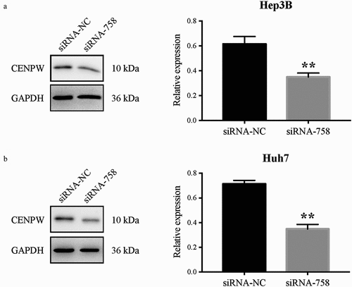 Figure 4. CENP-W protein expression level was significantly downregulated in (a) Hep3B and (b) Huh7 cells (**P < 0.01) after siRNA-758 transfection when compared to the siRNA-NC group.