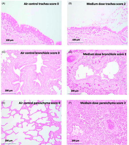 Figure 8. Hematoxylin and eosin stained sections (A) Air control, trachea, no injury (score 0), pseudostratified, ciliated, columnar epithelium with goblet cells. (B) Medium dose, trachea, moderate injury (score 2), erosion and degeneration of epithelium, edema, mixed inflammatory cell infiltration, and cellular debris, mucus, and erythrocytes in the lumen. (C) Air control, bronchiole, no injury (score 0). (D) Medium dose, bronchiole, moderate injury (score 2), erosion and degeneration of epithelium, mixed inflammatory cell infiltration, and sloughed epithelial cells, cellular debris, mucus and erythrocytes in the lumen. The surrounding parenchyma exhibits congestion, edema, fibrin exudation and polymorphonuclear cell infiltration. (E) Air control, lung parenchyma, no injury (score 0), (F) Medium dose, lung parenchyma, moderate injury (score 2), diffuse filling of alveolar spaces by eosinophilic fluid (edema) and fibrin strands, with congestion of alveolar capillaries and larger vessels, and numerous neutrophils within alveolar spaces and the interstitium.