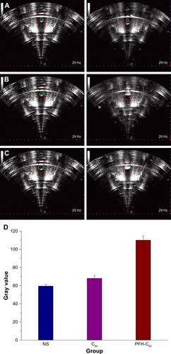 Figure 2 Ex vitro evaluations of the efficiencies of the same irradiation powers and time durations for ultrasound imaging under different groups [NS (A); C60 solutions (B); PFH-C60 solutions (C); left images: before irradiation, right images: after irradiation]. (D) Corresponding gray values of the interest region (each column is the average of three data points).Abbreviations: NS, normal saline; C60, fullerene; PFH, perfluorohexane.