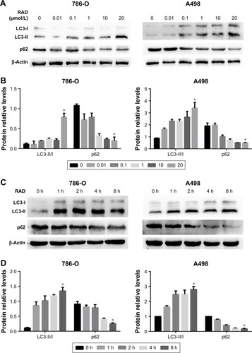 Figure 1 Everolimus (RAD001) induces autophagy in RCCs.