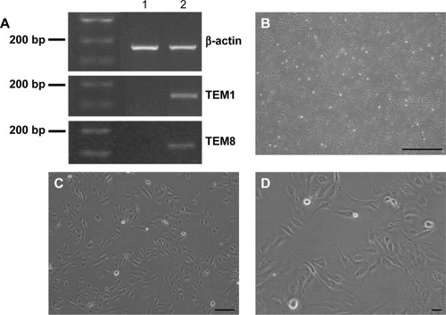 Figure 1 Td-EC detection and cell morphology.