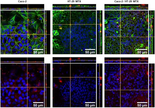 Figure 7 Laser scanning confocal microscopy images of f-actin (green), C16-HyA-Cy5.5 nanogels (red) and nuclei (DAPI, blue) of single cultures of Caco-2 and HT-29 and a Caco-2/HT-29 MTX co-culture. In the bottom images, the actin staining was omitted for clarity.