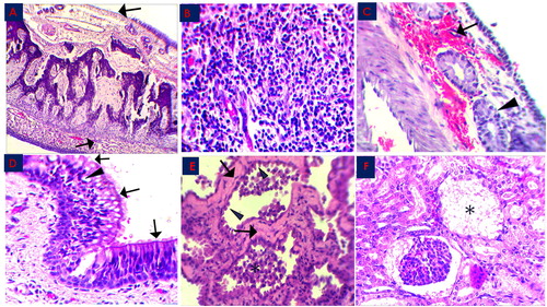 Figure 2. Histopathological changes in the MERS-CoV natural infected dromedary camels in Saudi Arabia 2018–2019.A: Nasal Turbinate showed exfoliation of the epithelial cells leaving denuded basement membrane (arrow), x100; B: Nasal Turbinate showed sub-epithelial mononuclear inflammatory cells infiltration (arrow), x400; C: Nasal Turbinate showed sub-epithelial hemorrhage (arrow) and glandular degeneration (arrowhead), x400; D: Trachea showed partial loss of cilia cells (arrow) and epithelial vacuolation (arrowhead), x400; E: Lung showed marked hyalinization of alveolar septa (arrow), with hypertrophy of pneumocytes type II (arrowhead) and intra-alveolar accumulation of macrophages (asterisk), x400; F: Renal Corpuscle showed marked fibrinous exudate with complete damage of glomerular tuft (asterisk), x400; all slides were stained with H&E stain.