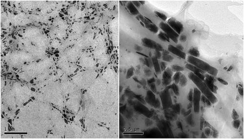 Figure 2. Transmission electron micrograph of the optimal FTN-loaded PEGylated Cerosomes (PC6).