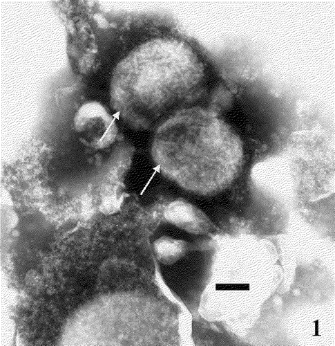Figure 1. Electron micrograph of FPV (arrows) stained with phosphotungstic acid (60 000× magnification). Bar=100 nm.