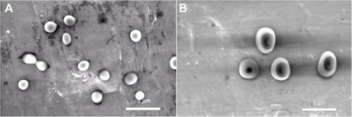 Figure 3 SEM images of gold labelled, drug-loaded nanoparticles. (A) monolayer nanoparticles and (B) double-layered nanoparticles. Scale bar: 1 µm.