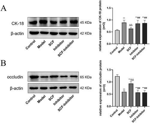 Figure 9. Effects of SCF on the expression of CK-18 and occludin after applying AKT inhibitors. Except the normal group and the inhibited group, the other groups were modeled with heat stress. (A) The expression of CK-18 protein. (B) The expression of occludin protein. Compared with the Control group, *p < 0.05 and **p < 0.01. Compared with the Model group, Δp < 0.05 and ΔΔp < 0.01. Compared with the SCF group, #p < 0.05 and ##p < 0.01.