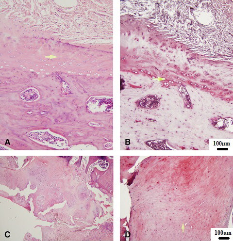 Figure 3. A. Control HE, B. Safranin O—Control, C. Implant HE, D—Safranin O—Implant. (A—Normal cartilage tissue; B—Arrow points on the deep zone of the cartilage tissue; C, D—Severe OA damage, cartilage and subchondral bone destruction.