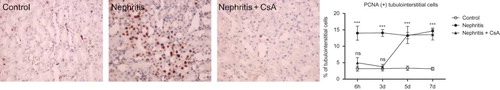 Figure 5.  PCNA expression in tubulointerstitium of rat kidneys during the experimental period and histological appearances of kidneys in control (at sixth hour), nephritis (at sixth hour), and nephritis + CsA (at sixth hour) groups. Values are expressed as mean ± SEM. n = 6 at each time point for each group. Notes: ***Denotes p < 0.001 against control group. ns, not significant against control group. CsA, cyclosporine A.