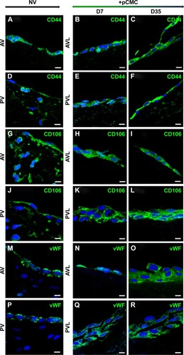 Figure 7 Immunodetection of CD44 (A–F), CD106 (G–L), and vWF (M–R) performed on AVL and PVL seeded with pCMC and cultured in vitro for 7 days (D7) and 35 days (D35).Notes: The expression of target markers in aortic (AV) and pulmonary (PV) native valves (NV) was also reported. Bar: 10 μm.Abbreviations: pCMC, porcine circulating multipotent cells; vWF, von Willebrand factor.