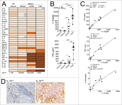 Figure 2. IL-18 was particularly represented in TUM of NSCLC patients. (A) Cytokines/chemokines amount (evaluated as pg/mL of mean values) is detected in Plasma of HD (N = 7), Plasma of NSCLC patients (N = 15) and in tissue conditioned media derived from NTUM (N = 5) and TUM (N = 10) of NSCLC patients. (B) Representative graph showing the amount of IL-18 and IFNγ evaluated as pg/mL; *p < 0.05, **p < 0.01, ***p <0.005, ****p < 0.0001 Mann–Withney test, 2-tailed. (C) Person correlation between IL-18 versus IFNγ and IL-12 amount in term of pg/mL. (D) IHC analysis (100× magnification) of IL-18 in NSCLC representative (IL-18low/high) patients (N = 2). The arrows indicated IL-18+ tumor cells.