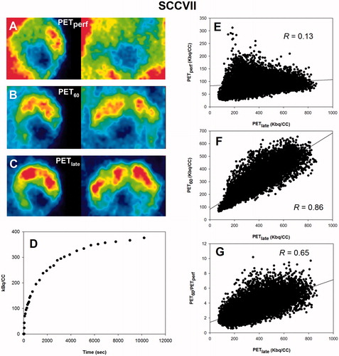 Figure 2. Scatterplot analysis for SCCVII. (A–C): PET images in two planes showing the time-dependent development of the intratumoral FAZA distribution in an SCCVII foot tumor. (D): whole-tumor TAC showing the distribution over time in average tumor tracer signal. (E): voxel-by-voxel correlation between late (PETlate: 160–180 min PI) and early (PETperf: 0–10 min PI) FAZA signal. (F): voxel-by-voxel correlation between PETlate and FAZA signal 60 min PI (PET60). (G): voxel-by-voxel correlation between PETlate and PET60 normalized to a perfusion surrogate measure derived as the average signal from 0 to 10 min PI (PET60/PETperf). FAZA: 18F-azomycin arabinoside; PET: positron emission tomography; PI: post-injection; TAC: time–activity curve.