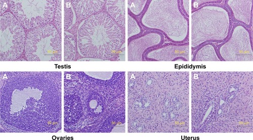Figure 10 Histologic sections of testis, epididymis, ovaries, and uterus.Notes: (A) The nano-Cu/LDPE group. (B) The control group. No abnormalities were detected in any groups.Abbreviation: Cu/LDPE, copper/low-density polyethylene nanocomposite.