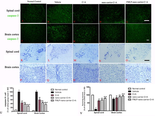 Figure 9. C + A compounds decreased apoptosis induced by EAE and increased neuronal survival in EAE rats at 2 weeks post-immunization. (A–J) Representative images of caspase-3 staining of spinal cord and cerebral cortex in different groups. (K–T) Representative images of Nissel staining of spinal cord and cerebral cortex in different groups. (U,V) Quantitative analysis of caspase-3 + cells (U) and survival neurons (V) in spinal cord and brain from different groups. a, p < .05 vs. normal control group; b, p < .05 vs. vehicle group; c, p < .05 vs. C + A group; d, p < 005 vs. nano-carrier C + A group. Scale bar = 100 µm.