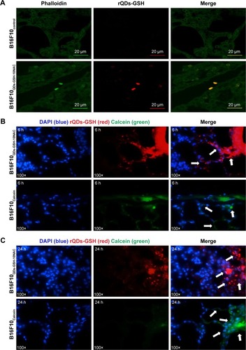 Figure 7 Presence and distribution of B16F10QDs-GSH-10NAC and B16F10Calcein cells in the lungs of C57BL/6 mice.Notes: B16F10QDs-GSH-10NAC, B16F10Calcein, and control cells were injected into the tail vein of C57BL/6 mice. Fluorescence signals due to either rQDs-GSH or Calcein were determined in lungs at 6 and 24 hours post-injection. (A) Confocal images of histological sections from lungs collected at 6 hours post-injection of B16F10QDs-GSH-10NAC or B16F10Control cells. (B) Confocal images of histological sections from lungs collected at 6 hours post-injection of B16F10QDs-GSH-10NAC or B16F10Calcein cells. (C) Confocal images of histological sections from lungs collected at 24 hours post-injection of B16F10QDs-GSH-10NAC or B16F10Calcein cells. White arrows show fluorescence due to presence of B16F10QDs-GSH-10NAC or B16F10Calcein cells. Note that the data shown were obtained in a double-blind study.Abbreviations: B16F10QDs-GSH-10NAC, B16F10 cells labeled with rQDs-GSH in presence of 10 mM of NAC; GSH, glutathione; NAC, N-acetylcysteine; QDs, quantum dots; rQDs-GSH, red QDs-GSH.