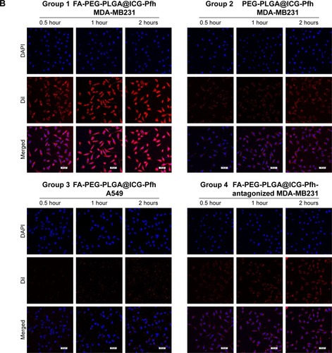 Figure 3 Cytotoxicity, in vitro cellular uptake, and anticancer effect of NPs.Notes: (A) Cytotoxicity against MDA-MB231 cells, A549 cells, and HUVECs after incubation with FA-PEG-PLGA@ICG-Pfh NPs (Ptx-free) for 24 hours. (B) Cellular uptake of different groups; DAPI (blue) marks nuclei and DiI (red) PLGA NPs. (C) Anticancer efficacy of different therapies against MDA-MB231 cells. *P<0.05. Abbreviations: NPs, nanoparticles; HUVECs, human umbilical vein endothelial cells; FA, folic acid; PEG, polyethylene glycol; PLGA, poly(lactide-co-glycolic acid); Ptx, paclitaxel; ICG, indocyanine green; Pfh, perfluorohexane.