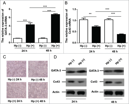 Figure 2. The effects of H. pylori on GATA-3 and Cx43 expressions in GES-1 cells. (A, B) Quantitative RT-PCR analysis of GATA-3 (A) and Cx43 (B) in GES-1 cells with H. pylori 24 and 48 hours infections. ** p < 0.01; *** p < 0.001. (C) Morphology of normal GES-1 cells and 24/48 hours H. pylori infected GES-1 cells. (D) Western blot analysis of GATA-3 and Cx43 protein levels in GES-1 cells under 24 and 48 hours H. pylori infections.