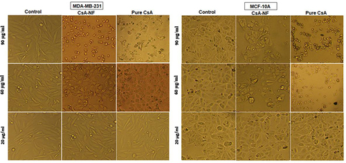 Figure 10 Cell morphology analysis of CsA and CsA-NF treated MDA-MB-231 and MCF-10A cells at 20x magnification.