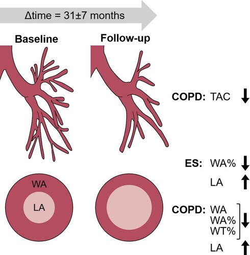 Figure 4. Schematic showing decreased TAC in ex-smokers with COPD. Schematic also shows decreased airway WA% and increased LA and VDP in ex-smokers without COPD (ES), as well as decreased airway WA, WA%, and WT%, and increased LA and VDP in ex-smokers with COPD.