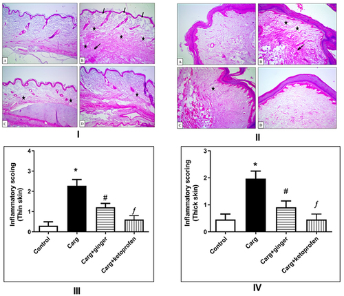 Figure 10 I and II: Histological examination (H&E, 100×) of rat-paw skin. Histological examination of paw skin in rat model of carrageenan-induced paw edema using H&E staining. (I) Thin-skin photomicrographs; (II) thick-skin photomicrographs:. IA and IIA: Control sections with normal histological structure in both thin and thick skin. IB and IIB: Sections obtained from positive control (carrageenan-induced edema without treatment) with detachment of epidermal layer (arrow), severe vacuolation, and edematous reaction in thin and thick skin (stars) and severe dermal inflammatory reaction in thin skin (double-headed arrow), as well as severe inflammatory reaction in dermal and muscular layers in thick skin (double-head arrow). IC and IIC: Sections obtained from animals treated with GE-HPMC-TRE3 hydrogel showed moderate dermal edematous and inflammatory reactions (stars). ID and IID: Sections obtained from animals pretreated with ketoprofen gel showed mild dermal edematous and inflammatory reaction (star). III and IV: Results of statistical analysis of inflammation scores of experimental groups for thin and thick skin.