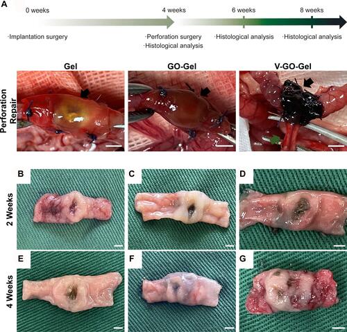 Figure 5 Evaluation of the perforation surgery and repair process. (A) Time course of the in vivo experiments and photos of the perforation surgery. The black arrow shows the perforation and repair area. (B–D) Macroscopic photographs showing the intestinal wounds acquired on week 2 after treatment with different scaffolds. (E–G) Macroscopic photographs showing the intestinal wounds acquired on week 4 after treatment with different scaffolds. (A scale bar=5mm; B-G scale bar=2mm).