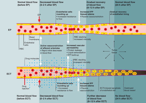 Figure 6. Model of blood flow changes in tumors induced by EP and ECT.The effects of EP alone and of ECT are presented on the level of a microcirculatory blood vessel. Application of the drug and electric pulses are indicated by the block arrows. The general sequence of physiological changes and their consequences runs from the left to the right.ECT: Electrochemotherapy; EP: Electroporation.