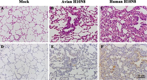 Figure 2. Pathological changes and viral replication in the lungs of inoculated pigs at 3 dpi. Hematoxylin and eosin staining (A–C) and immunohistochemical staining (D–E) of swine lungs. Pigs were inoculated with PBS (A and D), GD-E1 H10N8 virus (B and E), or JX346 H10N8 virus (C and F).