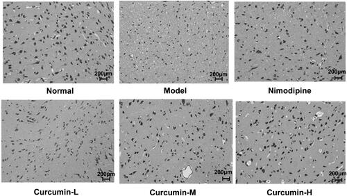 Figure 2. Effect of curcumin on glial cell pathology in rats. HE staining was performed. Representative images were shown. Scale bar: 200 μm.