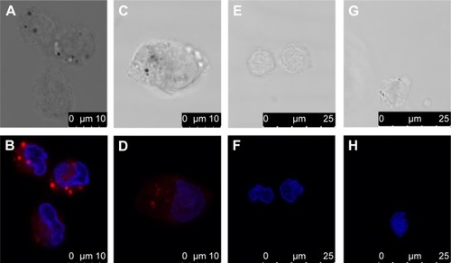 Figure 3 Uptake of nanoparticles.Notes: (A, C, E, and G) Bright field and (B, D, F, and H) fluorescent microscopic pictures of (A, B, E, and F) primary monocytes and (C, D, G, and H) the MM6 cell line made with confocal laser scanning microscopy. The cells were incubated for 4 hours with (A–D) 500 ng/mL PLGA nanoparticles or (E–H) SPIONs. The bright spots (B and D) indicate an agglomeration of particles. Nuclei are stained in blue with DAPI; red color indicates fluorescence of mTHPP-loaded nanoparticles or SPIONs.Abbreviations: PLGA, poly(lactic-co-glycolic acid); SPIONs, starch-coated superparamagnetic iron oxide nanoparticles; DAPI, 4′,6-diamidino-2-phenylindole; mTHPP, 5,10,15,20-Tetrakis-(3-hydroxyphenyl)-porphyrin.