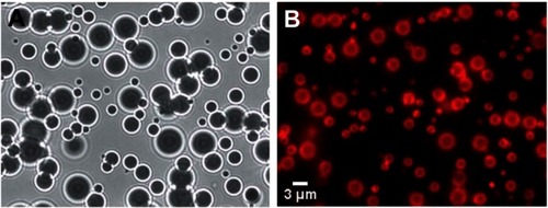 Figure 3 Images of microbubbles taken just after manufacturing. (A) White light illumination of the microbubbles. The density difference between the gas inside the microbubble and the surrounding water caused them to behave like lenses making them appear as dark circles with ring structures around them. (B) Fluorescent image of the same field of microbubbles showing the fluorescent dye that had been incorporated into the stabilizing lipid monolayer surrounding each microbubble.