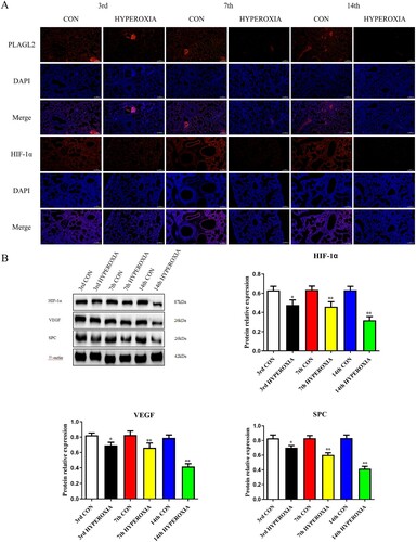 Figure 1. Hyperoxia exposure reduces the expression of PLAGL2, HIF-1α, VEGF, and SPC. (A) Immunofluorescence staining revealed that the expression of PLAGL2 and HIF-1α in lung tissues of the CON group was higher compared to the corresponding HYPEROXIA group on the 3rd day, 7th day, and 14th day. (B) Western blot analysis was performed to assess the protein expression levels of HIF-1α, VEGF, and SPC. The protein expression levels of HIF-1α, VEGF, and SPC were significantly decreased after hyperxoia exposure compared to the CON group. Statistical significance was determined as *p < 0.05, **p < 0.01, ***p < 0.001.