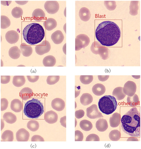 Figure 2. Lymphoma (a), blast (b), lymphocyte (c) and other cell (d).