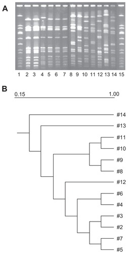 Figure 2 (A) Lanes 1 and 15, NCTC8325; Lanes 2, 3, 4, representative ST772 patterns from skin and soft tissue infections; Lanes 5, 6, 7, and 9, ST772 isolates from lacrimal sac abscess, orbital cellulitis, corneal ulcer and microbial keratitis respectively; Lanes 8 and 11, ST1 isolates from microbial keratitis; Lanes 10, ST672 isolate from socket infection; Lane 12, ST88 isolate from orbital abscess; Lane 13, ST72 isolate from microbial keratitis; Lane 14, ST5 isolate from microbial keratitis. (B) Dendrogram showing the similarities derived from the unweighted pair group method with arithmatic mean and dice coefficients using the Quantity One® 1-D Analysis Software.