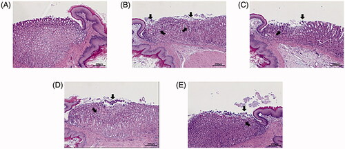 Figure 5. Hematoxylin-eosin (H&E) staining of histological section of the gastric mucosa in the gastric glands in EtOH/HCl-induced rats. Arrow heads indicate erosion and hemorrhage. (A) Control (B) EtOH/HCl (C) HemoHIM 250 mg kg−1 (D) HemoHIM 500 mg kg−1 (E) Cimetidine 100 mg kg−1.