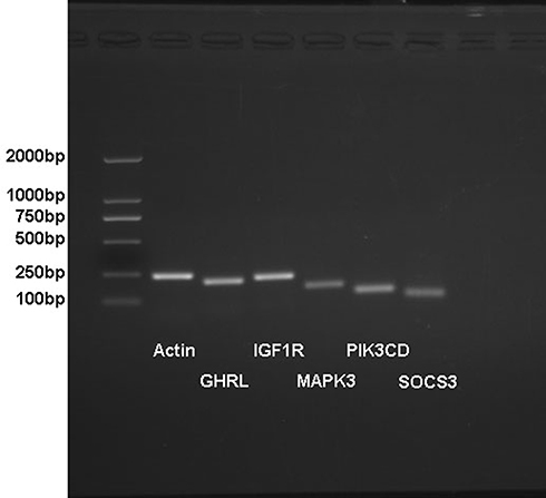Figure 5 The electropherogram of PCR primer identification.