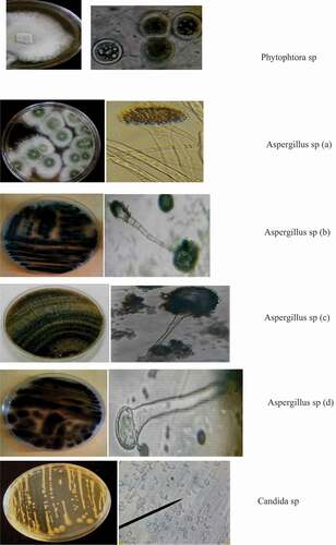 Figure 2. Macroscopic and microscopic view of fungi isolated on zucchini