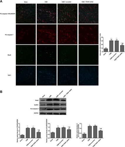 Figure 8 Inhibition TXNIP declined the NLRP3 mediated pro-caspase-1 expression in the anterior horn of the lesioned area following CSM. (A) The mean fluorescence intensities of pro-caspase-1/NeuN were analyzed by immunofluorescence. (B) The expression levels of TXNIP, NLRP3 and pro-caspase-1 in the lesioned spinal cords were measured by Western blot. The mean grays were analyzed by the Image J software. Compared with the sham group, **P<0.01; compared with the scrambled group, ##P<0.01.