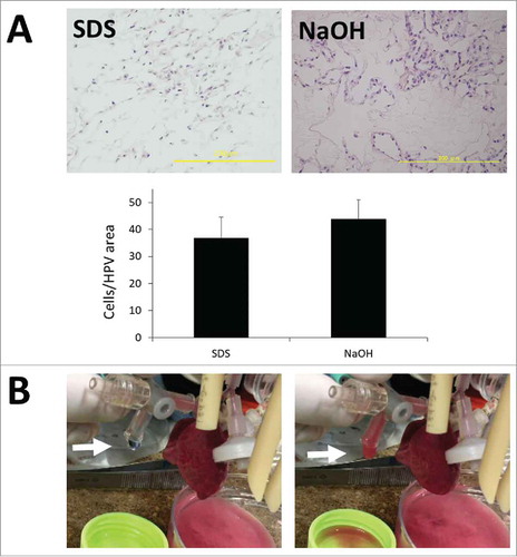 FIGURE 5. (A) Histopathological findings of SDS-treated and NaOH-treated recellularized lung. Scale bar = 200 μm. Bar graph showing the average number of reseeded HUVECs within a high power view (HPV) area (P = 0.310). (B) Findings of gas exchange functional analysis. Note hemoglobin vesicles-PBS solution was harvested from the cannulated pulmonary vein (white arrow).