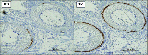 Figure 1.  Immunohistochemistry staining of serial feather follicle sections 21 d.p.i. from a chicken simultaneously challenged with JM/102W and rMd5/pp38CVI. Sections on the left and right were stained with H19 and T65 monoclonal antibodies, respectively (Experiment 1A).