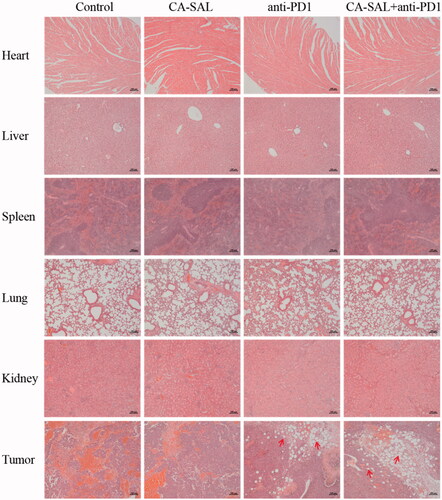 Figure 9. Histopathology of heart, liver, spleen, lung, kidney and tumor sections with hematoxylin and eosin (H&E) staining of different experimental groups. Note: Scale bar = 100 μm.